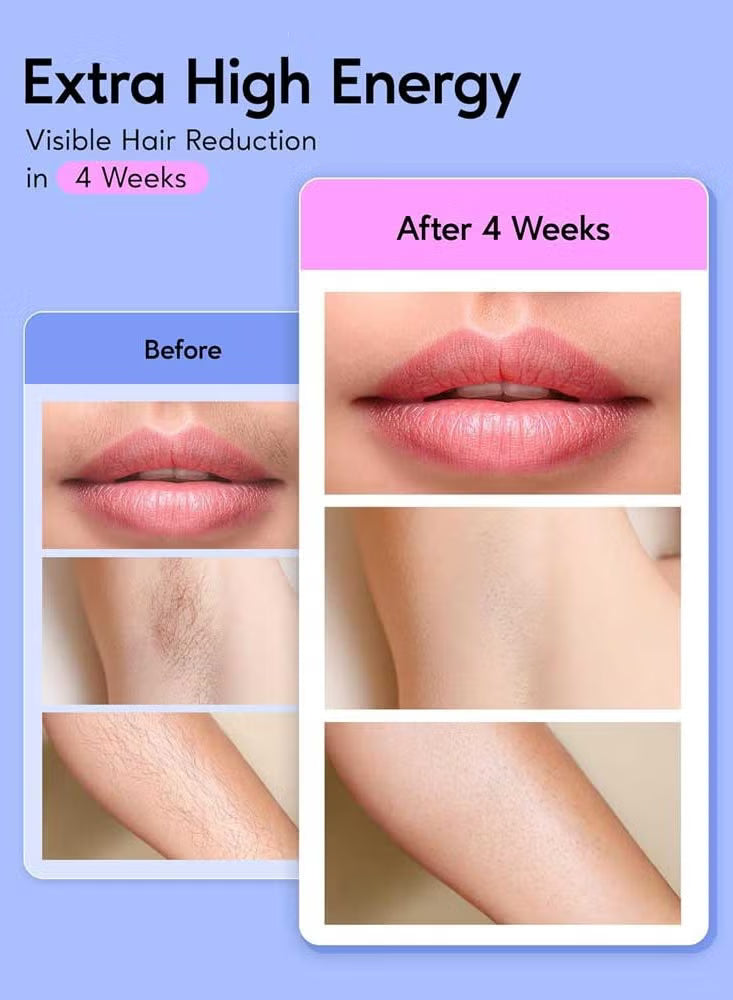 Babyverse - IPL Hair Removal Device for Women